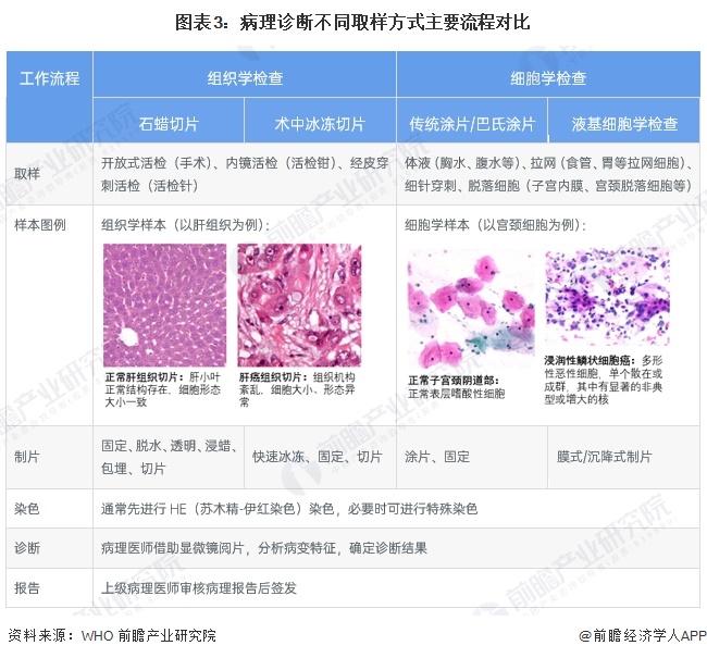 图表3：病理诊断不同取样方式主要流程对比